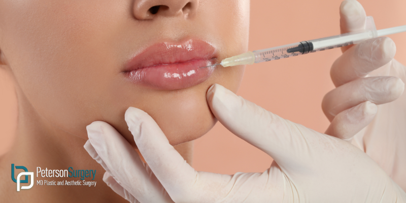 Understanding Non-Surgical Skin Treatments at Peterson MD Plastic and Aesthetic Surgery